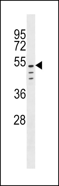 CLEC18C Antibody (C-term) (Cat. #AP18950b) western blot analysis in A2058 cell line lysates (35ug/lane).This demonstrates the CLEC18C antibody detected the CLEC18C protein (arrow).