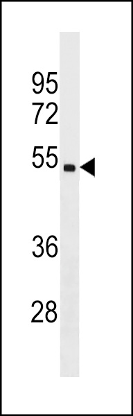CHST5 Antibody (C-term) (Cat. #AP18949b) western blot analysis in ZR-75-1 cell line lysates (35ug/lane).This demonstrates the CHST5 antibody detected the CHST5 protein (arrow).