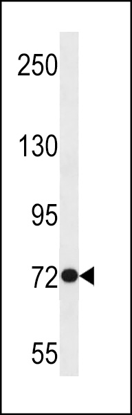 ANKRD56 Antibody (Center) (Cat. #AP18942c) western blot analysis in Jurkat cell line lysates (35ug/lane).This demonstrates the ANKRD56 antibody detected the ANKRD56 protein (arrow).