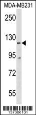 COBLL1 Antibody (N-term) (Cat. #AP18934a) western blot analysis in MDA-MB231 cell line lysates (35ug/lane).This demonstrates the COBLL1 antibody detected the COBLL1 protein (arrow).