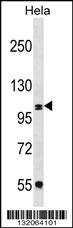 COPB2 Antibody (C-term) (Cat. #AP18930b) western blot analysis in Hela cell line lysates (35ug/lane).This demonstrates the COPB2 antibody detected the COPB2 protein (arrow).