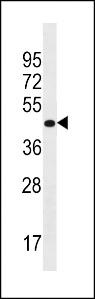 PRR25 Antibody (C-term) (Cat. #AP18927b) western blot analysis in Uterus tissue lysates (35ug/lane).This demonstrates the PRR25 antibody detected the PRR25 protein (arrow).