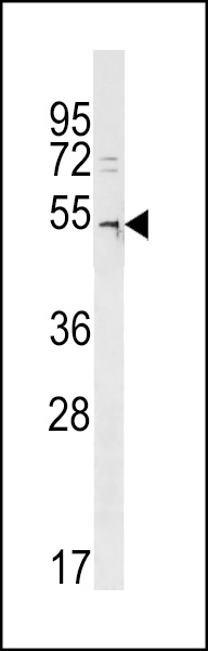 DCAF12L2 Antibody (C-term)(Cat. #AP18777b) western blot analysis in A2058 cell line lysates (35ug/lane).This demonstrates the DCAF12L2 antibody detected the DCAF12L2 protein (arrow).