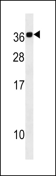 CABP2 Antibody (N-term) (Cat. #AP19160a) western blot analysis in A549 cell line lysates (35ug/lane).This demonstrates the CABP2 antibody detected the CABP2 protein (arrow).