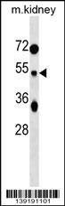 TUFT1 Antibody (C-term) (Cat. #AP19158b) western blot analysis in mouse kidney tissue lysates (35ug/lane).This demonstrates the TUFT1 antibody detected the TUFT1 protein (arrow).