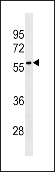 LRRC69 Antibody (Center) (Cat. #AP19147c) western blot analysis in HepG2 cell line lysates (35ug/lane).This demonstrates the LRRC69 antibody detected the LRRC69 protein (arrow).