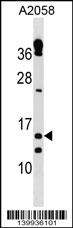 TXNRD3IT1 Antibody (C-term) (Cat. #AP19096b) western blot analysis in A2058 cell line lysates (35ug/lane).This demonstrates the TXNRD3IT1 antibody detected the TXNRD3IT1 protein (arrow).