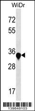 AMMECR1 Antibody (C-term) (Cat. #AP19068b) western blot analysis in WiDr cell line lysates (35ug/lane).This demonstrates the AMMECR1 antibody detected the AMMECR1 protein (arrow).