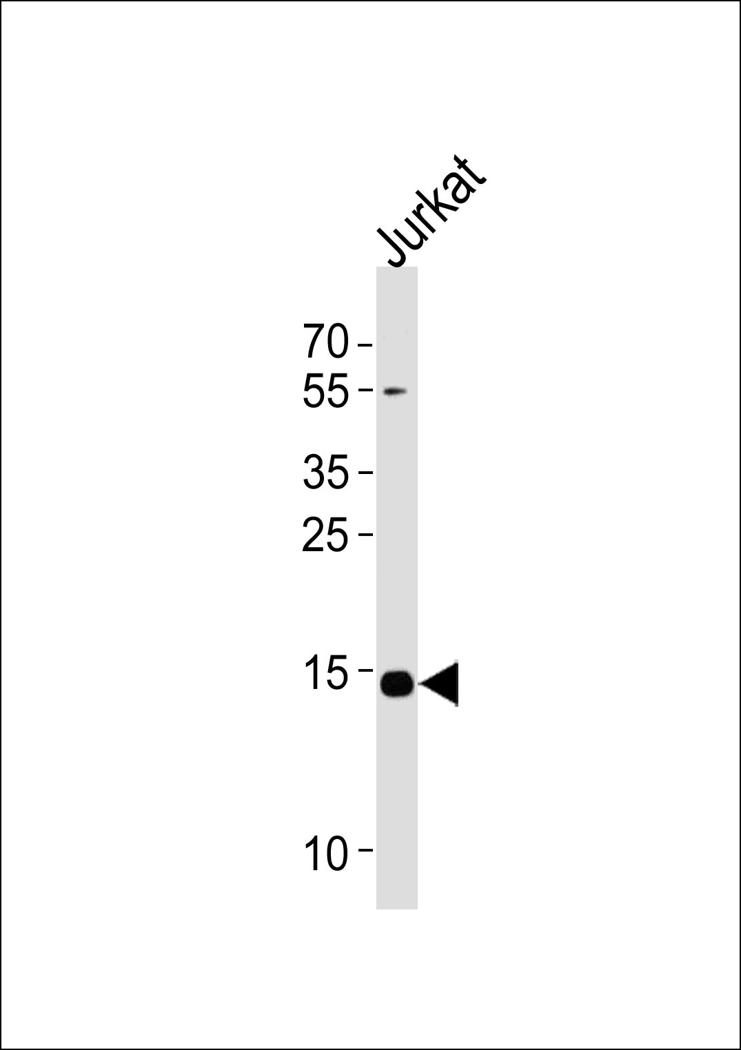 Western blot analysis of lysate from Jurkat cell line, using UBE2D4 Antibody (C-term)(Cat. #AP19059b). AP19059b was diluted at 1:1000 at each lane. A goat anti-rabbit IgG H&L(HRP) at 1:5000 dilution was used as the secondary antibody. Lysate at 35ug per lane.