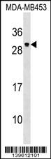 PDF Antibody (Center) (Cat. #AP19023c) western blot analysis in MDA-MB453 cell line lysates (35ug/lane).This demonstrates the PDF antibody detected the PDF protein (arrow).