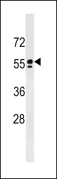 SPAM1 Antibody (C-term) (Cat. #AP19001b) western blot analysis in Jurkat cell line lysates (35ug/lane).This demonstrates the SPAM1 antibody detected the SPAM1 protein (arrow).