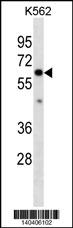 COL10A1 Antibody (N-term)(Cat. #AP19393a) western blot analysis in K562 cell line lysates (35ug/lane).This demonstrates the COL10A1 antibody detected the COL10A1 protein (arrow).