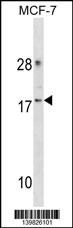 CDK2AP2 Antibody (Center)(Cat. #AP19378c) western blot analysis in MCF-7 cell line lysates (35ug/lane).This demonstrates the CDK2AP2 antibody detected the CDK2AP2 protein (arrow).