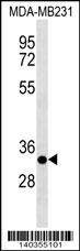 CAPNS2 Antibody (Center)(Cat. #AP19354c) western blot analysis in MDA-MB231 cell line lysates (35ug/lane).This demonstrates the CAPNS2 antibody detected the CAPNS2 protein (arrow).