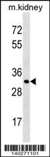 Mouse Ctsl1 Antibody (C-term)(Cat. #AP19338b) western blot analysis in mouse kidney tissue lysates (35ug/lane).This demonstrates the Ctsl1 antibody detected the Ctsl1 protein (arrow).
