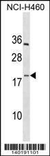 PF4V1 Antibody (C-term)(Cat. #AP19316b) western blot analysis in NCI-H460 cell line lysates (35ug/lane).This demonstrates the PF4V1 antibody detected the PF4V1 protein (arrow).