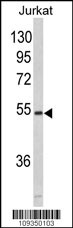 Western blot analysis of MFAP1 (Cat. #AP1928b) in Jurkat cell line lysates (35ug/lane). MFAP1 (arrow) was detected using the purified Pab.