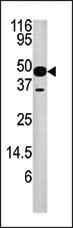 Western blot analysis of anti-NUP54 Pab (Cat. #AP1924b) in mouse heart tissue lysate.NUP54(arrow) was detected using the purified Pab.