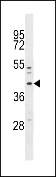 MFF Antibody (Center) (Cat. #AP19240c) western blot analysis in NCI-H460 cell line lysates (35ug/lane).This demonstrates the MFF antibody detected the MFF protein (arrow).