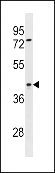 SIRPB2 Antibody (C-term) (Cat. #AP19194b) western blot analysis in ZR-75-1 cell line lysates (35ug/lane).This demonstrates the SIRPB2 antibody detected the SIRPB2 protein (arrow).