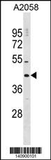 DNAJC25 Antibody (Center) (Cat. #AP19655c) western blot analysis in A2058 cell line lysates (35ug/lane).This demonstrates the DNAJC25 antibody detected the DNAJC25 protein (arrow).