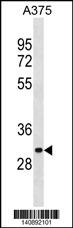 ARMCX6 Antibody (N-term) (Cat. #AP19653a) western blot analysis in A375 cell line lysates (35ug/lane).This demonstrates the ARMCX6 antibody detected the ARMCX6 protein (arrow).