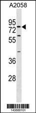 SYT16 Antibody (Center) (Cat. #AP19651c) western blot analysis in A2058 cell line lysates (35ug/lane).This demonstrates the SYT16 antibody detected the SYT16 protein (arrow).