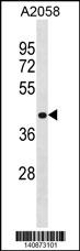 RNF149 Antibody (Center) (Cat. #AP19648c) western blot analysis in A2058 cell line lysates (35ug/lane).This demonstrates the RNF149 antibody detected the RNF149 protein (arrow).
