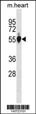 Mouse Gpi Antibody (C-term) (Cat. #AP19643b) western blot analysis in mouse heart tissue lysates (35ug/lane).This demonstrates the Mouse Gpi antibody detected the Mouse Gpi protein (arrow).
