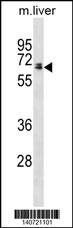 Rat Ggt1 Antibody (N-term) (Cat. #AP19641a) western blot analysis in mouse liver tissue lysates (35ug/lane).This demonstrates the Rat Ggt1 antibody detected the Rat Ggt1 protein (arrow).