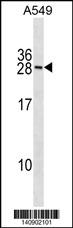 RNF182 Antibody (N-term) (Cat. #AP19609a) western blot analysis in A549 cell line lysates (35ug/lane).This demonstrates the RNF182 antibody detected the RNF182 protein (arrow).
