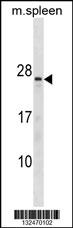 TNNC2 Antibody (C-term) (Cat. #AP19581b) western blot analysis in mouse spleen tissue lysates (35ug/lane).This demonstrates the TNNC2 antibody detected the TNNC2 protein (arrow).