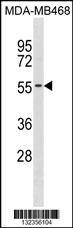 KCNK6 Antibody (C-term) (Cat. #AP19580b) western blot analysis in MDA-MB468 cell line lysates (35ug/lane).This demonstrates the KCNK6 antibody detected the KCNK6 protein (arrow).