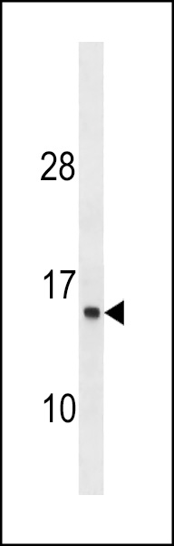 ATP6V1G1 Antibody (C-term) (Cat. #AP19555b) western blot analysis in ZR-75-1 cell line lysates (35ug/lane).This demonstrates the ATP6V1G1 antibody detected the ATP6V1G1 protein (arrow).
