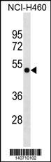 GTPBP3 Antibody (Center) (Cat. #AP19547c) western blot analysis in NCI-H460 cell line lysates (35ug/lane).This demonstrates the GTPBP3 antibody detected the GTPBP3 protein (arrow).