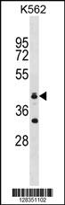 RNF175 Antibody (Center) (Cat. #AP19513c) western blot analysis in K562 cell line lysates (35ug/lane).This demonstrates the RNF175 antibody detected the RNF175 protein (arrow).