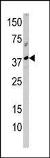 Western blot analysis of anti-RCL1 Pab (Cat. #AP1949a) in A375 cell line lysate (35ug/lane). RCL1(arrow) was detected using the purified Pab.