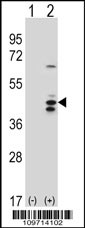 Western blot analysis of RCL1 (arrow) using rabbit polyclonal RCL1 Antibody (Cat. #AP1949a). 293 cell lysates (2 ug/lane) either nontransfected (Lane 1) or transiently transfected (Lane 2) with the RCL1 gene.