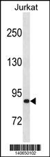 ZNF337 Antibody (C-term) (Cat. #AP19493b) western blot analysis in Jurkat cell line lysates (35ug/lane).This demonstrates the ZNF337 antibody detected the ZNF337 protein (arrow).