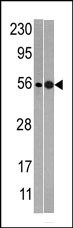 Western blot analysis of anti-NMD3 Pab (Cat. #AP1948b) in mouse heart (left) and T47D (right)tissue lysates (35ug/lane). NMD3(arrow) was detected using the purified Pab.