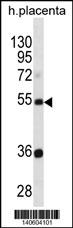 TEKT3 Antibody (N-term) (Cat. #AP19474a) western blot analysis in human placenta tissue lysates (35ug/lane).This demonstrates the TEKT3 antibody detected the TEKT3 protein (arrow).