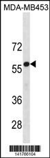 UGT2B4 Antibody (N-term) (Cat. #AP19747a) western blot analysis in MDA-MB453 cell line lysates (35ug/lane).This demonstrates the UGT2B4 antibody detected the UGT2B4 protein (arrow).