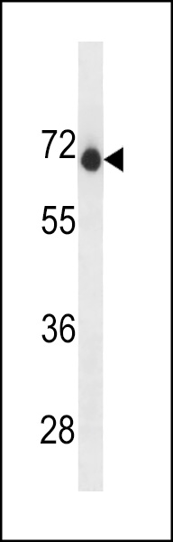 ENDOD1 Antibody (Center) (Cat. #AP19740c) western blot analysis in A2058 cell line lysates (35ug/lane).This demonstrates the ENDOD1 antibody detected the ENDOD1 protein (arrow).
