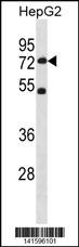 SETD3 Antibody (C-term) (Cat. #AP19739b) western blot analysis in HepG2 cell line lysates (35ug/lane).This demonstrates the SETD3 antibody detected the SETD3 protein (arrow).
