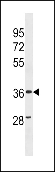 ZC3HAV1L Antibody (C-term) (Cat. #AP19737b) western blot analysis in human Uterus tissue lysates (35ug/lane).This demonstrates the ZC3HAV1L antibody detected the ZC3HAV1L protein (arrow).