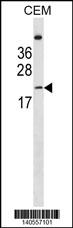 LIN7B Antibody (N-term) (Cat. #AP19782a) western blot analysis in CEM cell line lysates (35ug/lane).This demonstrates the LIN7B antibody detected the LIN7B protein (arrow).