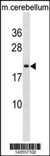 LIN7B Antibody (N-term) (Cat. #AP19782a) western blot analysis in mouse cerebellum tissue lysates (35ug/lane).This demonstrates the LIN7B antibody detected the LIN7B protein (arrow).