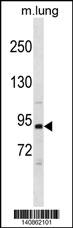 Mouse Pik3r1 Antibody (N-term) (Cat. #AP19794a) western blot analysis in mouse lung tissue lysates (35ug/lane).This demonstrates the Mouse Pik3r1 antibody detected the Mouse Pik3r1 protein (arrow).