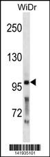 PCSK5 Antibody (N-term) (Cat. #AP19980a) western blot analysis in WiDr cell line lysates (35ug/lane).This demonstrates the PCSK5 antibody detected the PCSK5 protein (arrow).