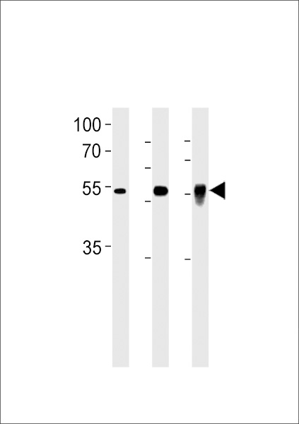 DMRTA2 Antibody (C-term) (Cat. #AP19969b) western blot analysis in PC-3 cell line, mouse testis and zebra fish brain tissue lysates (35ug/lane).This demonstrates the DMRTA2 antibody detected the DMRTA2 protein (arrow).
